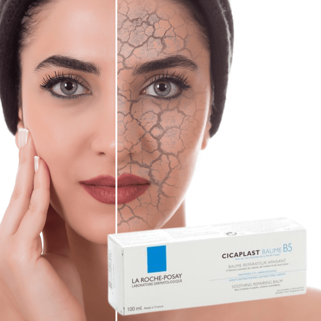 Droge Huid Cicaplast