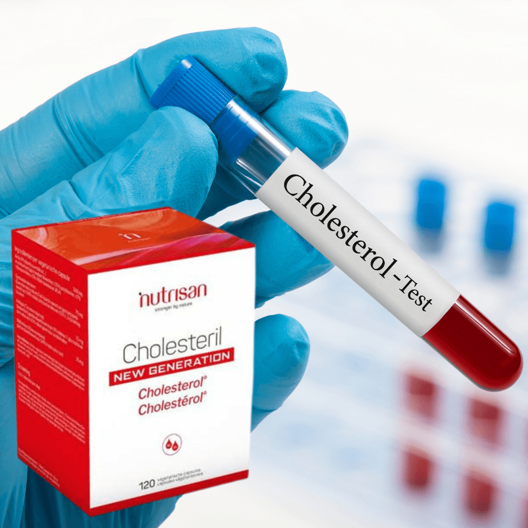 Cholesterol
