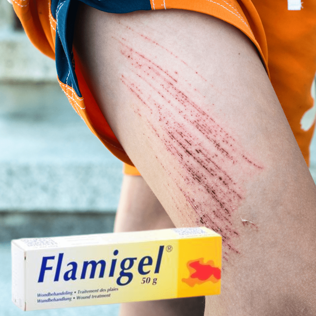 Flamigel Schaafwonden