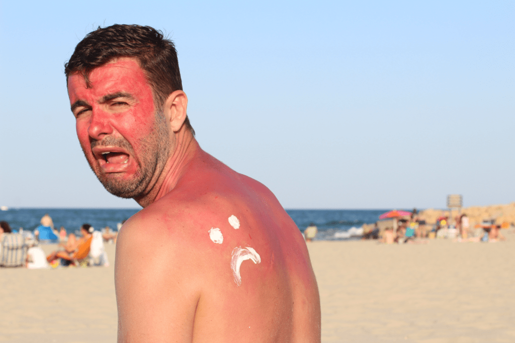 3 Goede Redenen Waarom Je Aftersun Moet Gebruiken!