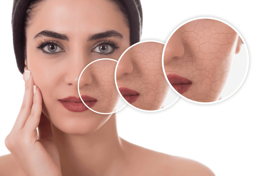 Hoe Een Droge Huid Behandelen