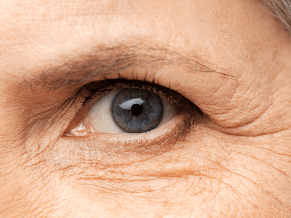 Ontdek Deze 9 Tips Om Rimpels Te Voorkomen