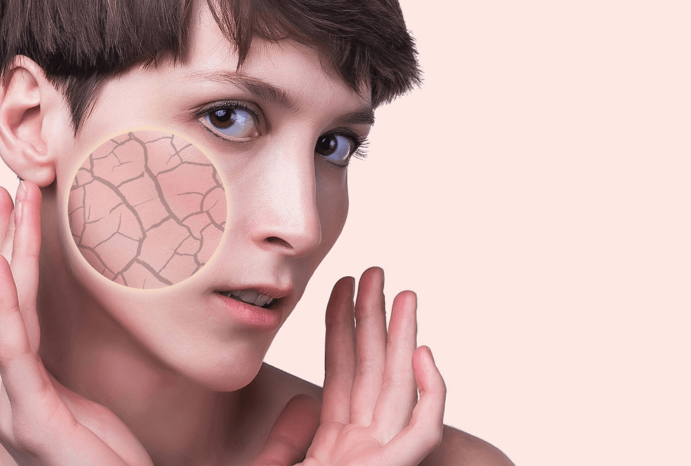 Ontdek Onze 10 Tips Om Een Droge Huid Te Voorkomen!