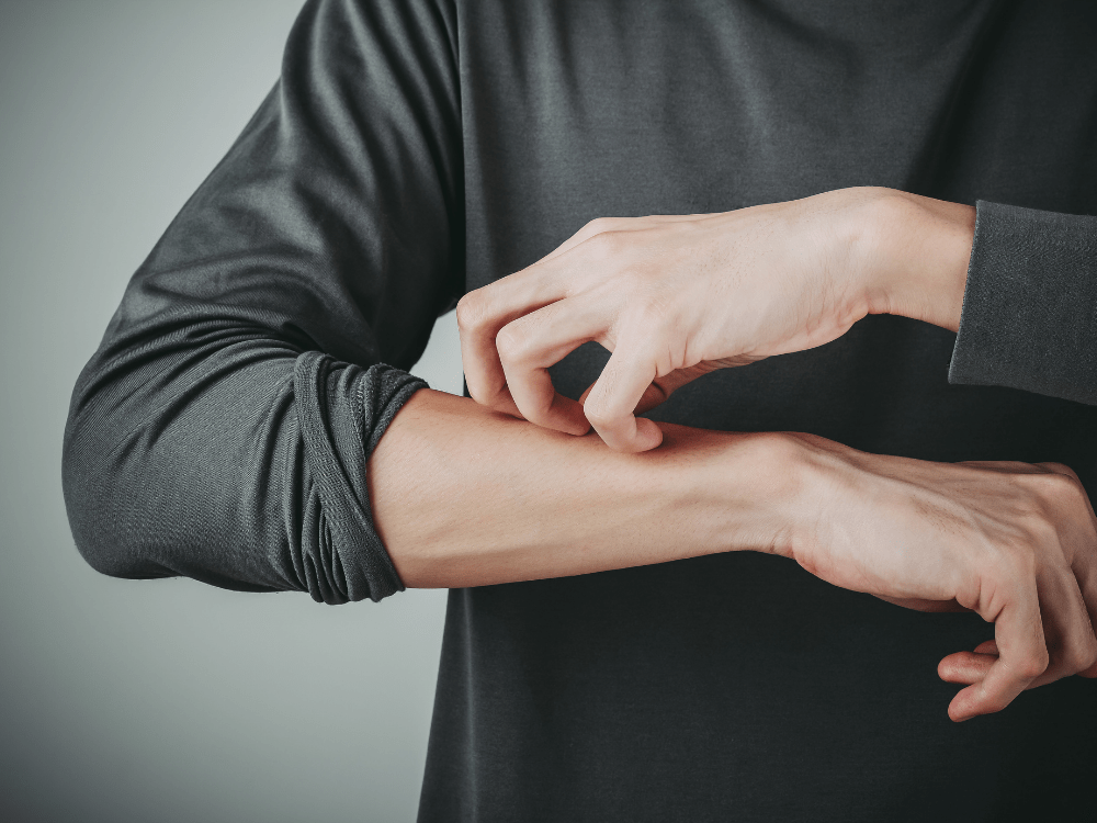 Wat Is Jeuk En Wat Kan Je Er Tegen Doen