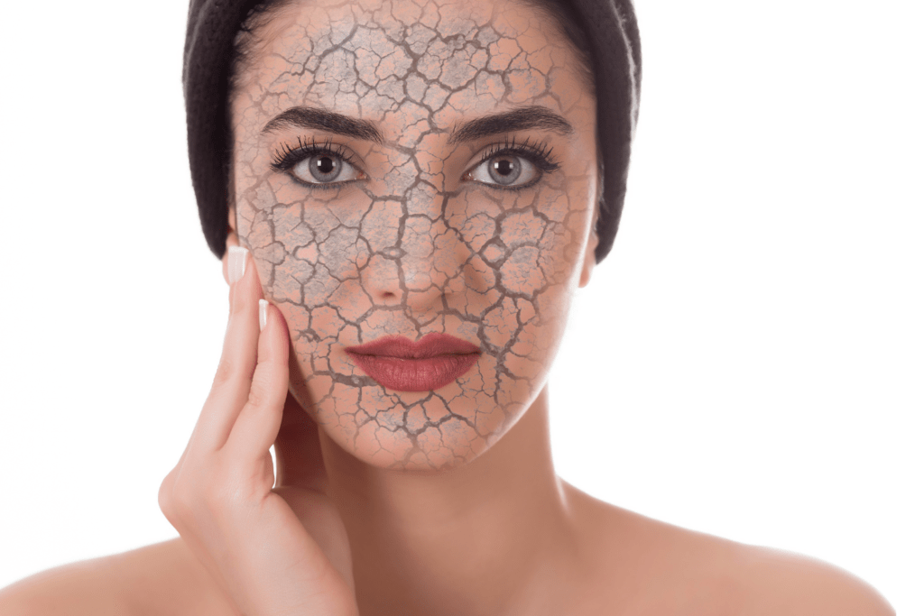 Wat Kan Je Doen Tegen Een Droge Huid Na De Zomervakantie