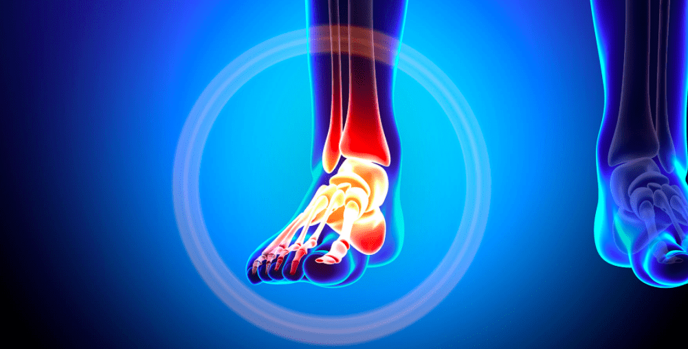 Kan Suppletie Met Collageenpeptiden De Stabiliteit Van De Gewrichten Verbeteren