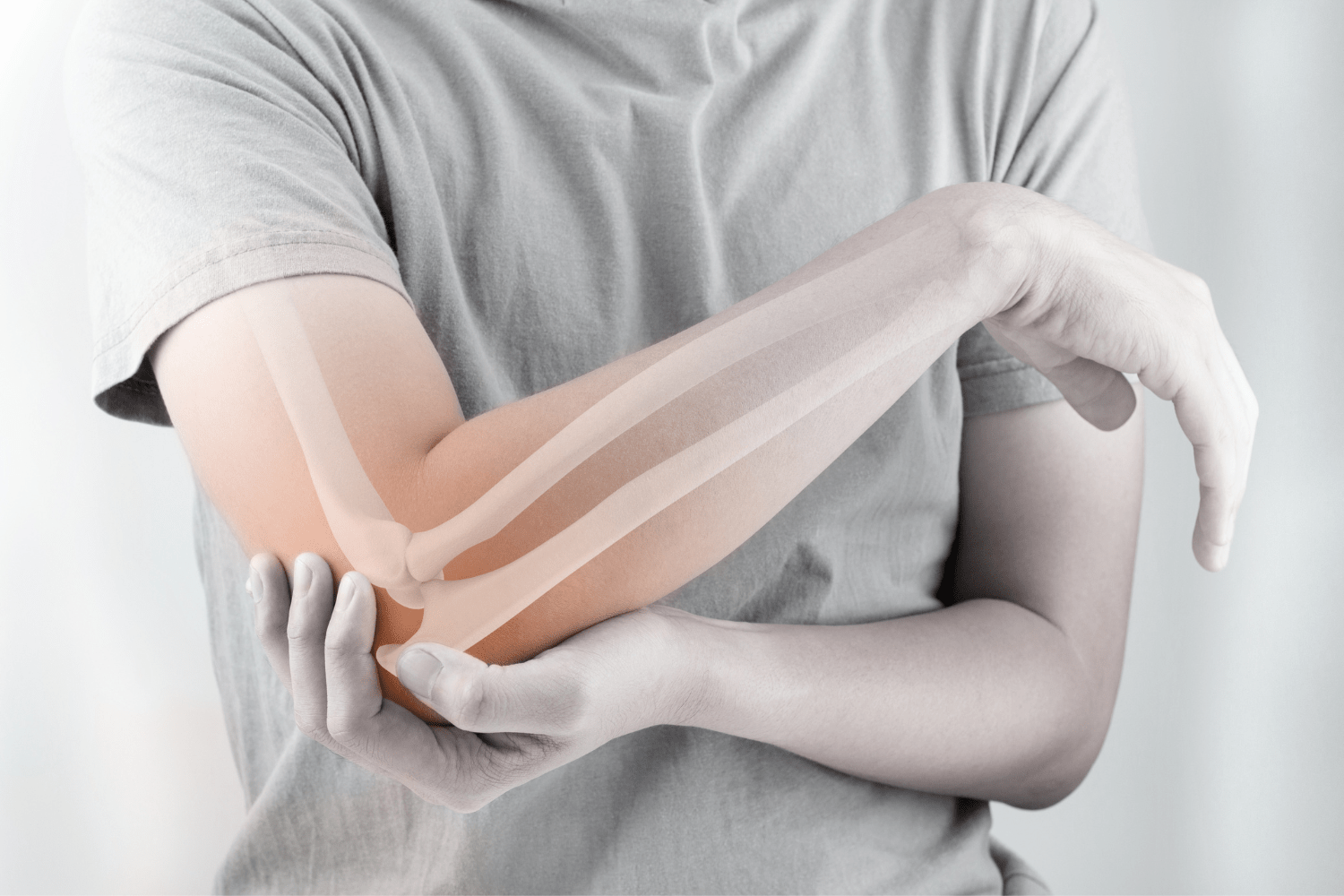 Ontdek Het Belang Van Calcium Om Botbreuken Te Voorkomen