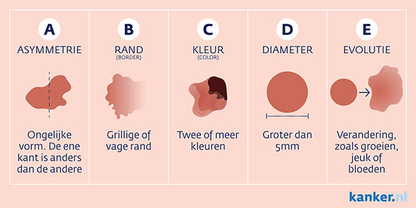 Wat Moet Je Weten Over Huidkanker En Hoe Je Huidkanker Kan Voorkomen!