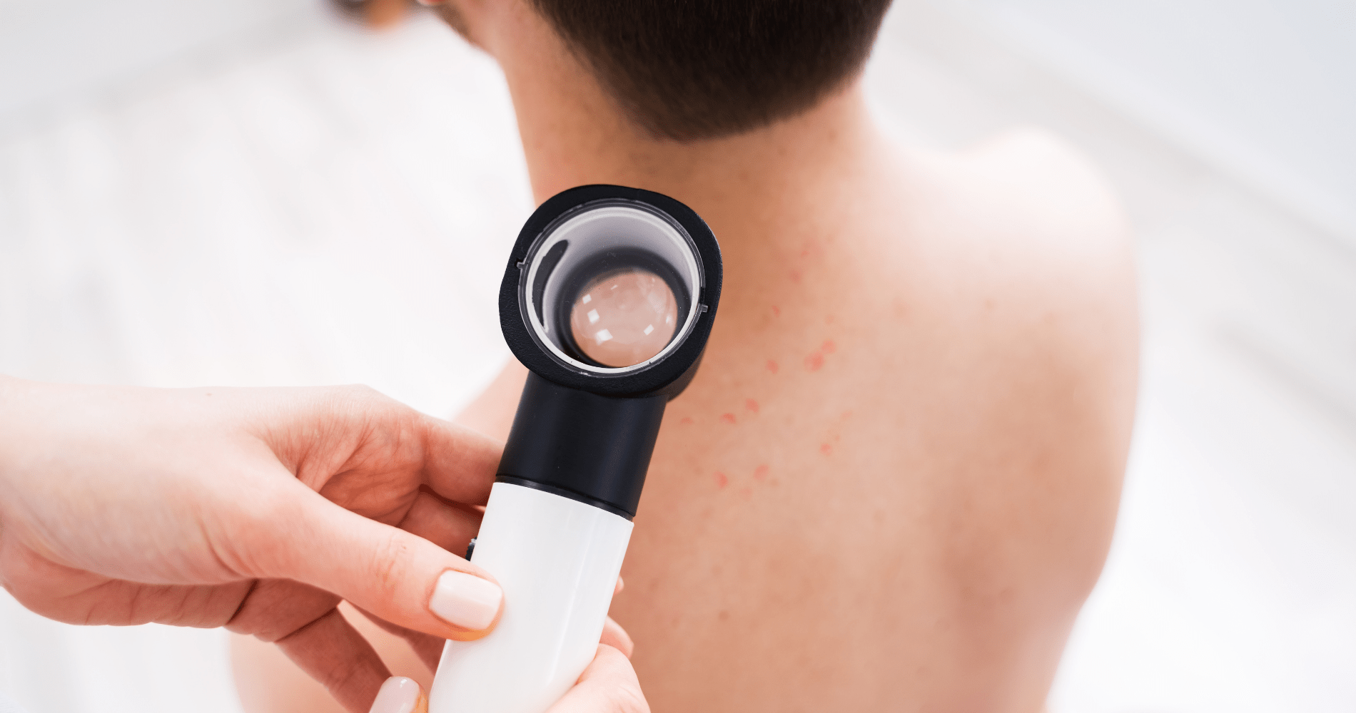 Weet Jij Wat De Link Is Tussen Bruine Vlekjes En De Zon