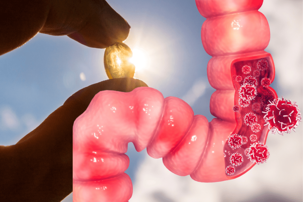 Welke Rol Speelt Vitamine D Bij Het Ontwikkelen Van Darmkanker