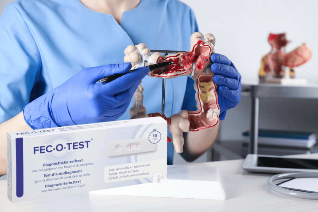 Laat Je Op Tijd Nakijken Tegen Dikkedarmkanker.